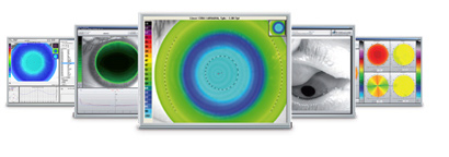 Color images produced by the keratograph
